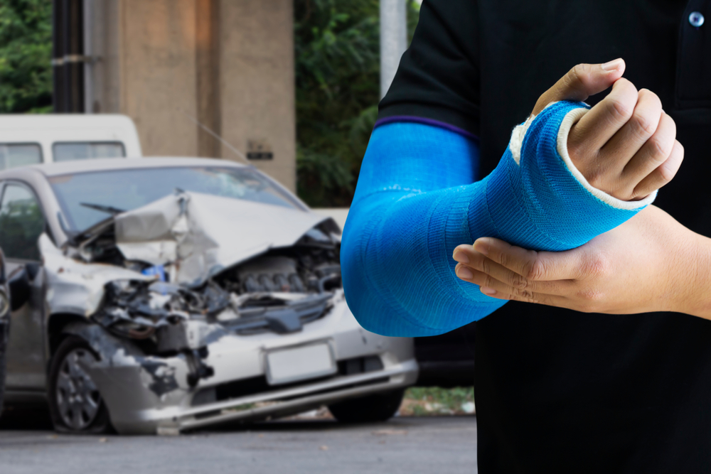 Photo of an Hand Injured Person