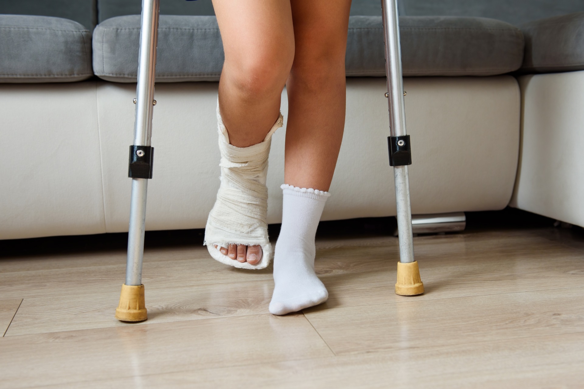 Broken Leg