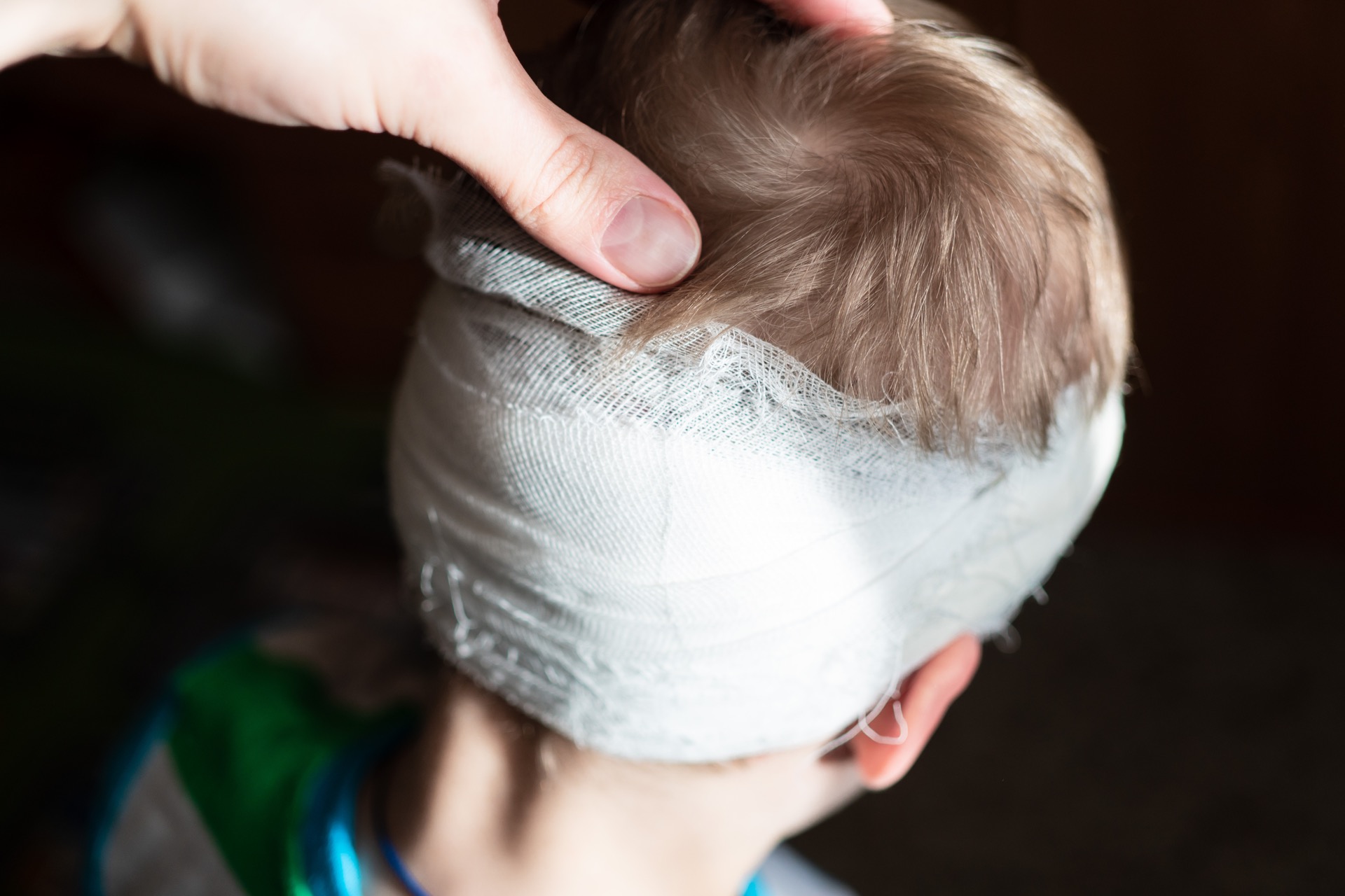 Photo of an Injured Head