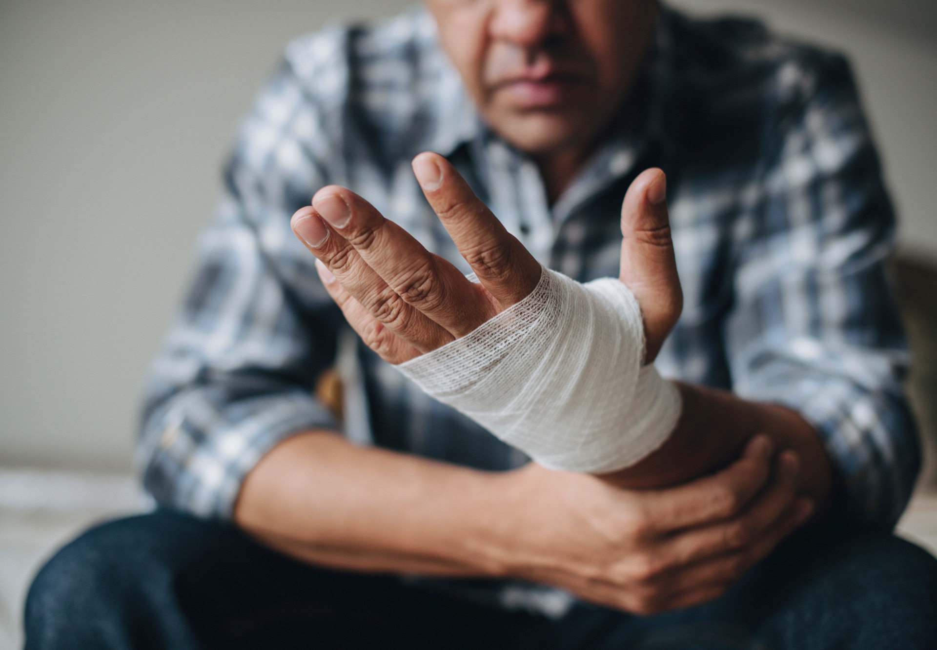 Photo of an Injured Hand